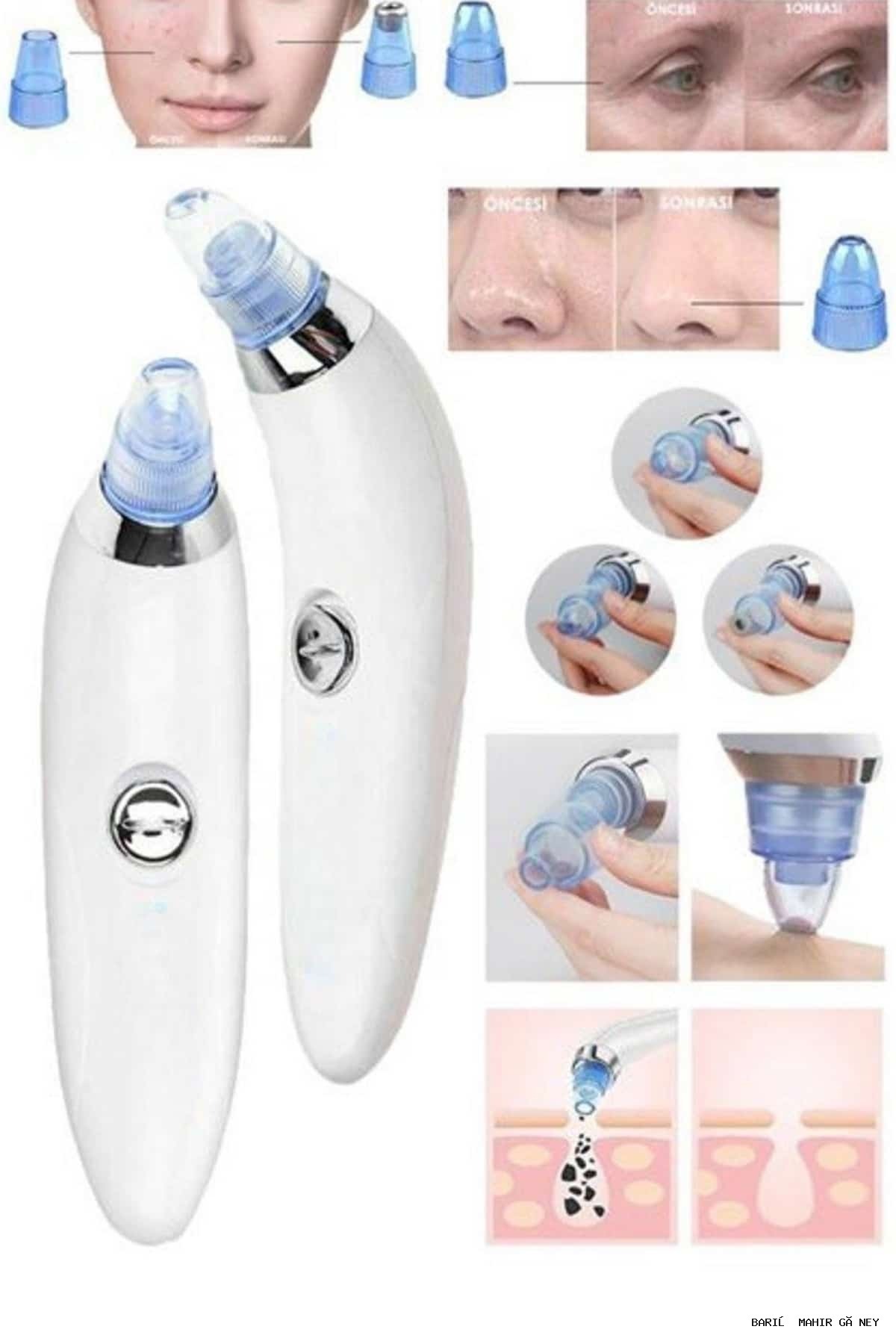دستگاه پاک کننده وکیوم جوش های سرسیاه و صورت NAZBLSMM (185103) با 4 سر — NAZBLSMM6000121497720910 — تصویر 4 از 5