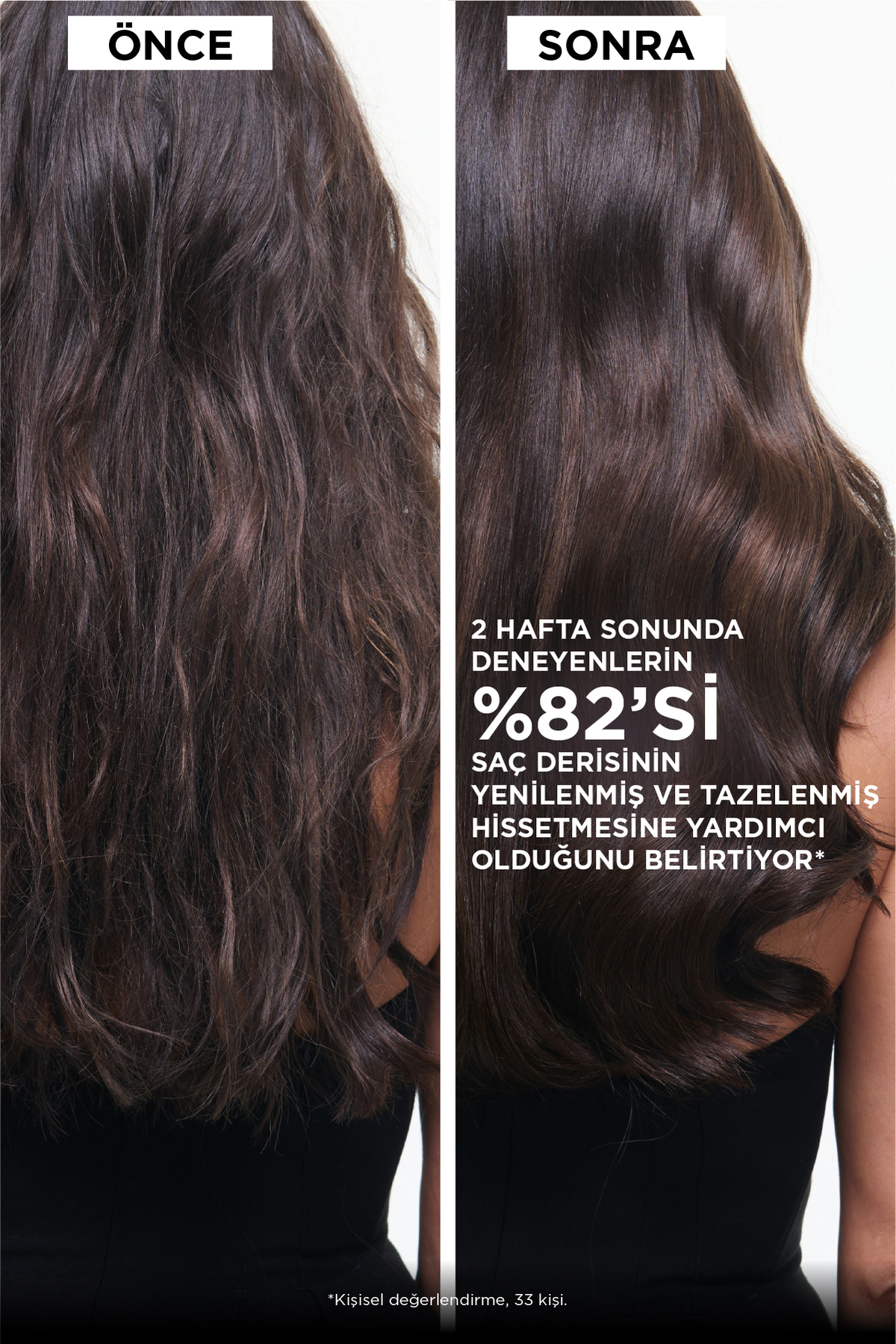 سرم پوست سر کرونولوژیست برای موهای ضعیف شده در اثر پیری، 30 میلی لیتر — E4588200 — تصویر 4 از 8