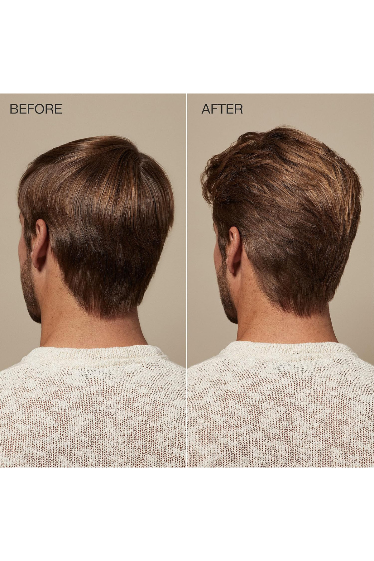 Scalp Care Regenıplex Bakım Kremi 300 ml — 11 — تصویر 5 از 7
