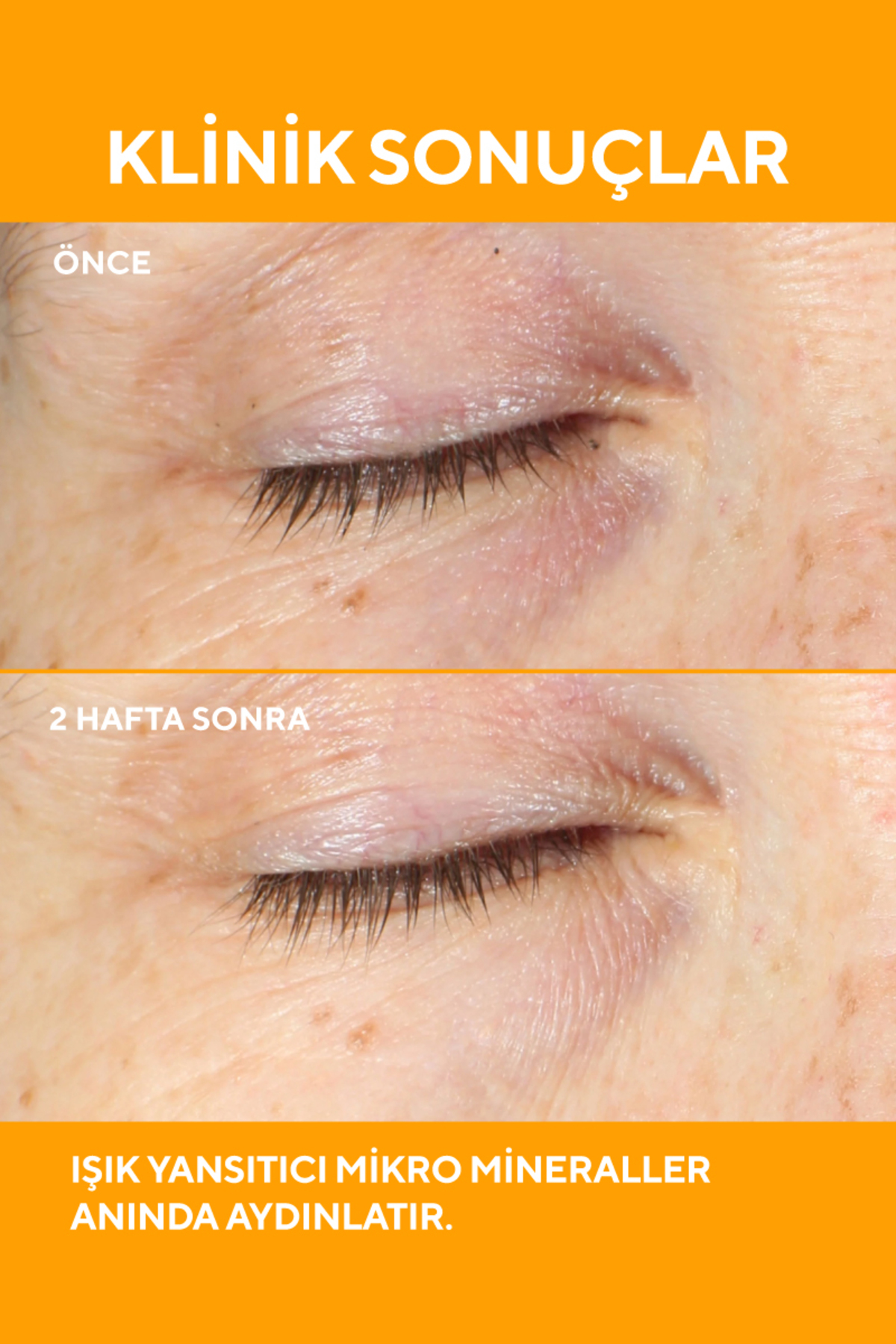 Göz Serumu - Environmental Shield Vita-C Eyes Dark Circle Corrector C Vitaminli Koyu Halka Karşıtı 15 ml — MR.01.PER.025 — تصویر 3 از 5