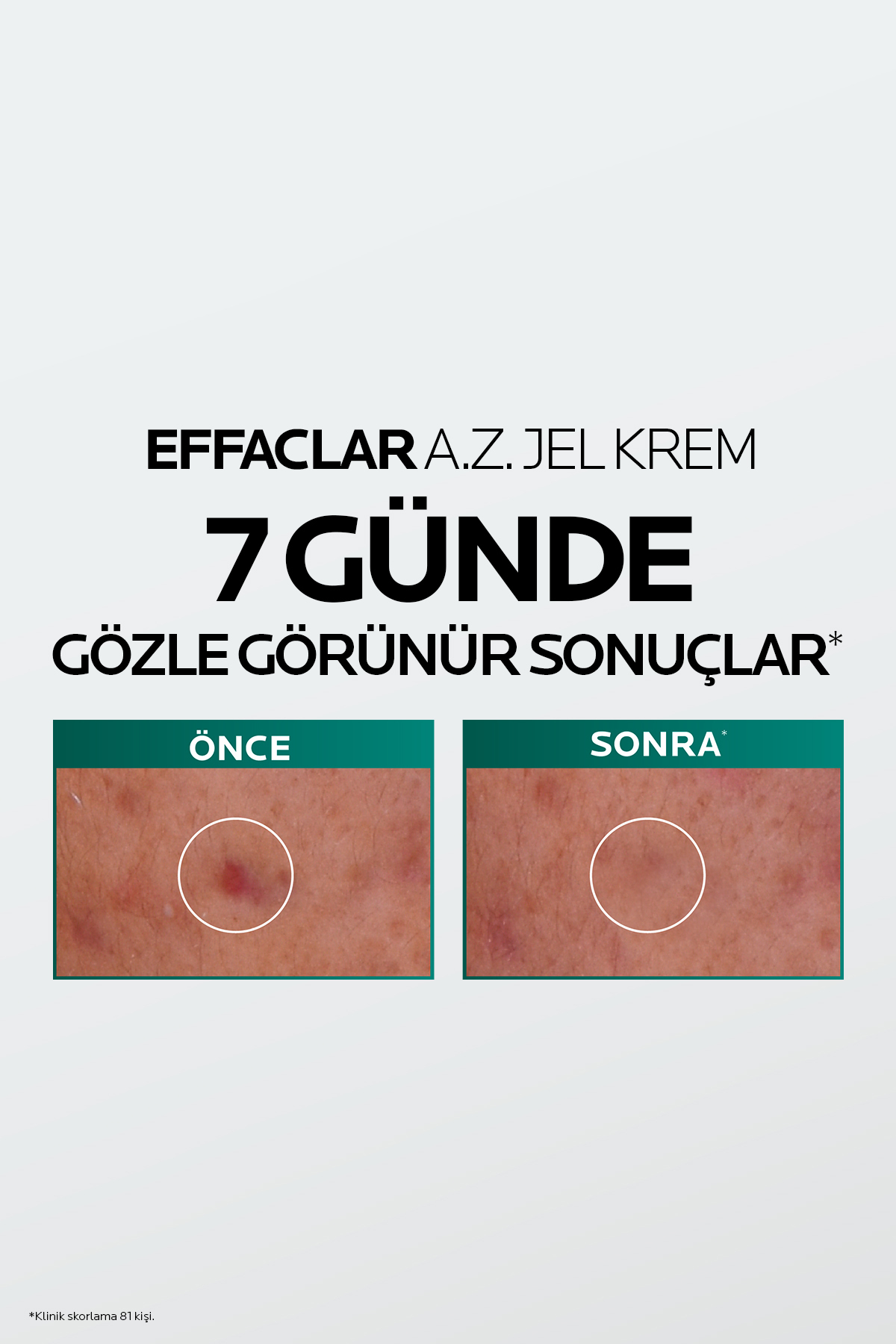 ست مراقبت از صورت و مو: کرم ژل Effaclar A.Z. 40 میلی لیتر و شامپو ضد شوره Dercos 50 میلی لیتر
