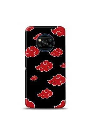 Xiaomi Poco X3 Pro Naruto Anime Tasarımlı Telefon Kılıfı-naruto3 mars1223057