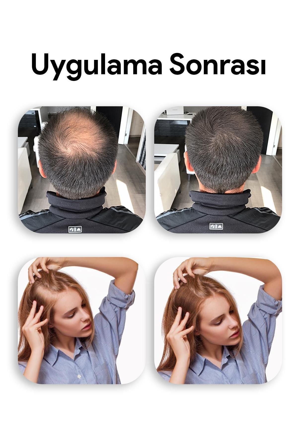 luis bien sac dolgunlastirici sprey sari 100 ml fiyati yorumlari trendyol