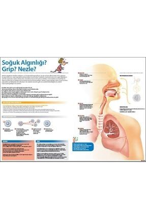 Grip, Nezle Ve Soğuk Algınlığı Afişi (folyo) 70x100 Cm afbiyoloji31ybyk