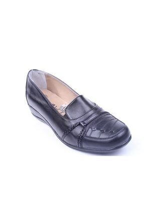 061 Kadın Büyük Numara Siyah Günlük Ortop Anne Ayakkabısı MK061-EDK-BYK