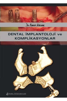 Dental Implantoloji Ve Komplikasyonlar 9786053352662