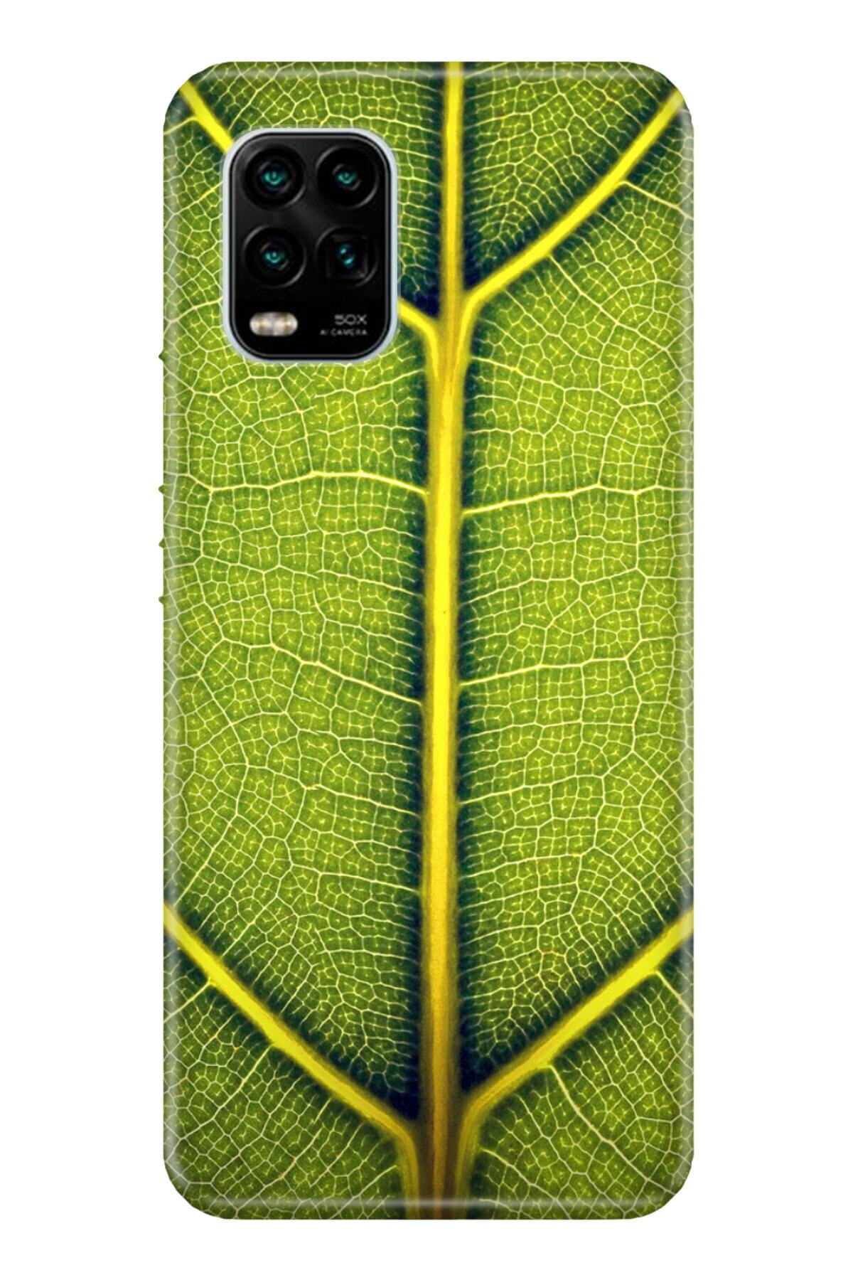 Https Www Trendyol Com Elfimo Sony Xperia Xa Ultra Kanye West Uyumlu Desenli Kilif P 78151158 Https Cdn Dsmcdn Com Ty61 Product Media Images 20210122 9 56039285 132924986 1 1 Org Zoom Jpg Sony Xperia Xa Ultra Kanye West Uyumlu Desenli