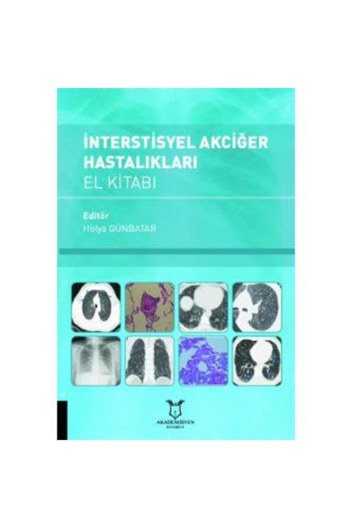 Akademisyen Kitabevi Interstisyel Akciğer Hastalıkları El Kitabı