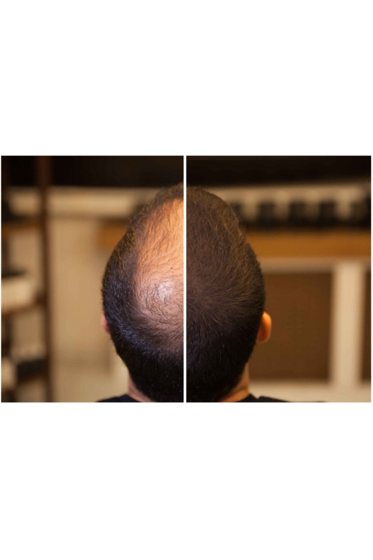 FIXPLANT Saç Dolgunlaştırıcı Saç Tozu Topik 28 Gr. | 30 Saniyede Seyrek Saçlardan Kurtulun
