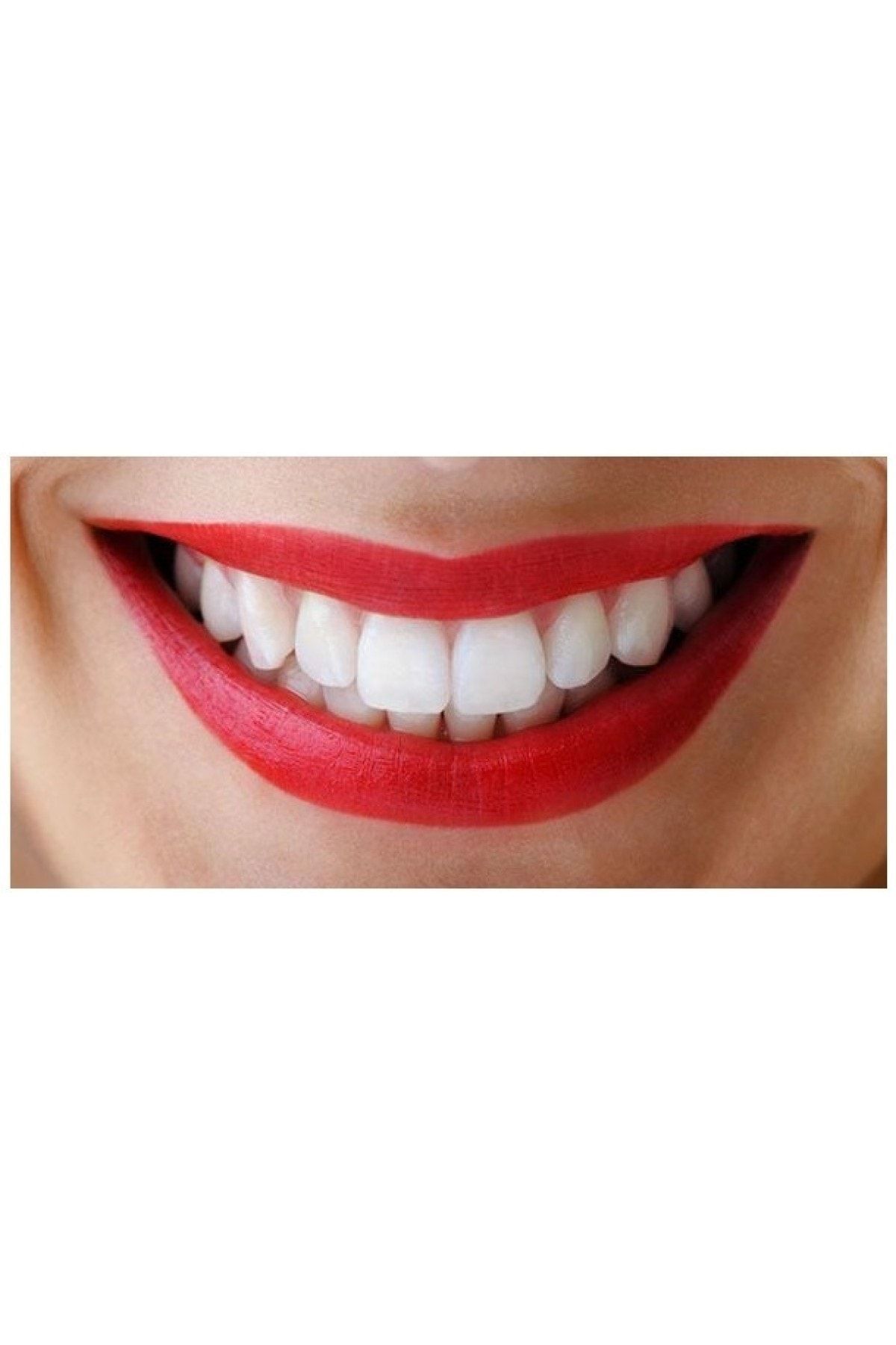 diamond dental dis beyazlatma ve