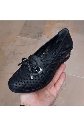 Kadın Içi-dışı Hakiki Deri Ortopedik Dolgu Taban Delikli Siyah Ayakkabı AYK100054