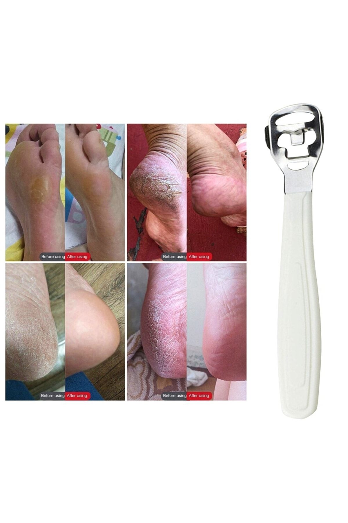 Adil Baba-Practical Scraper Heel Cleaning Tool - Callus Razor 4