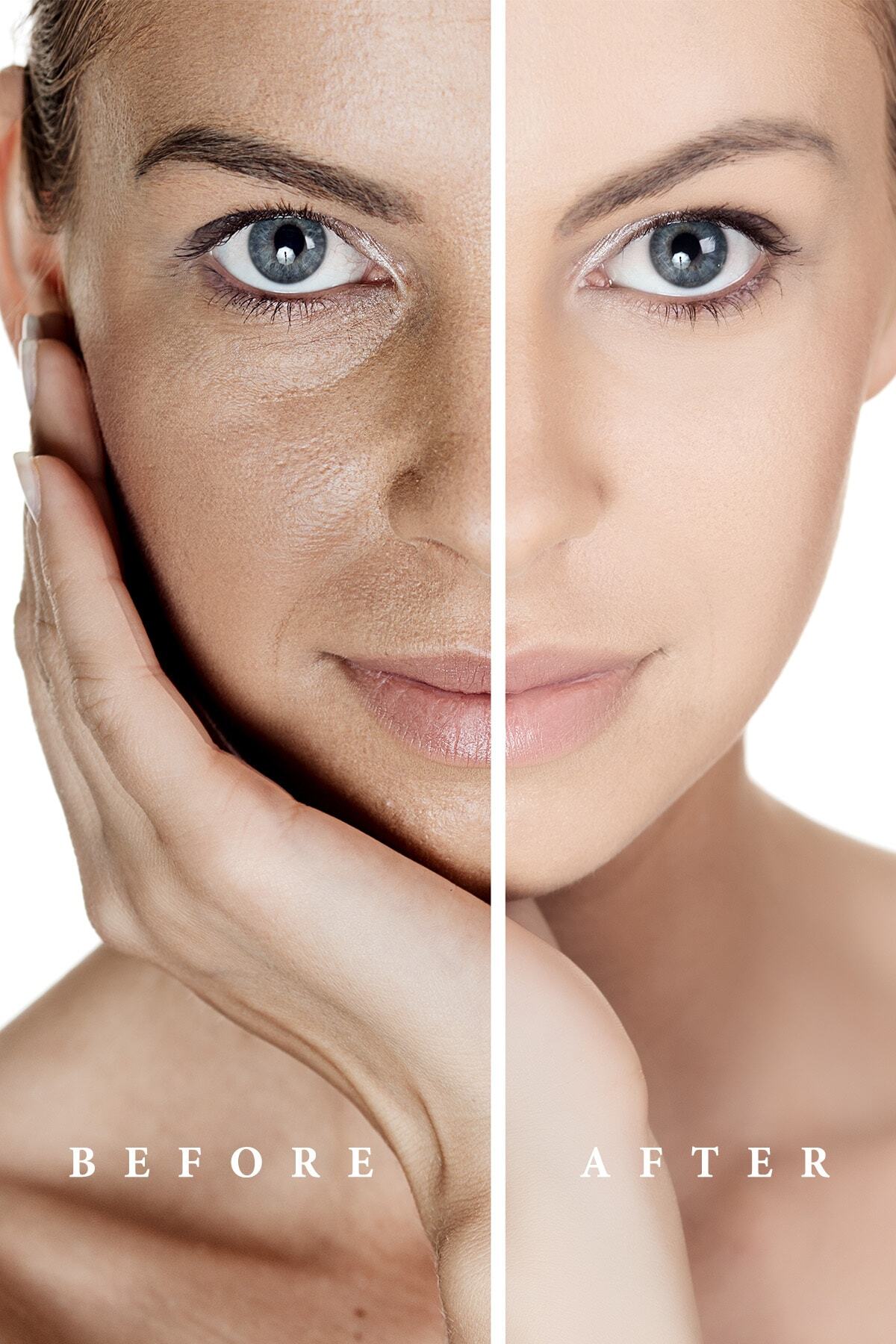 کرم چشم   Pureexen Cosmetıcs Laboratory | PE-003 اورجینال - تصویر 4