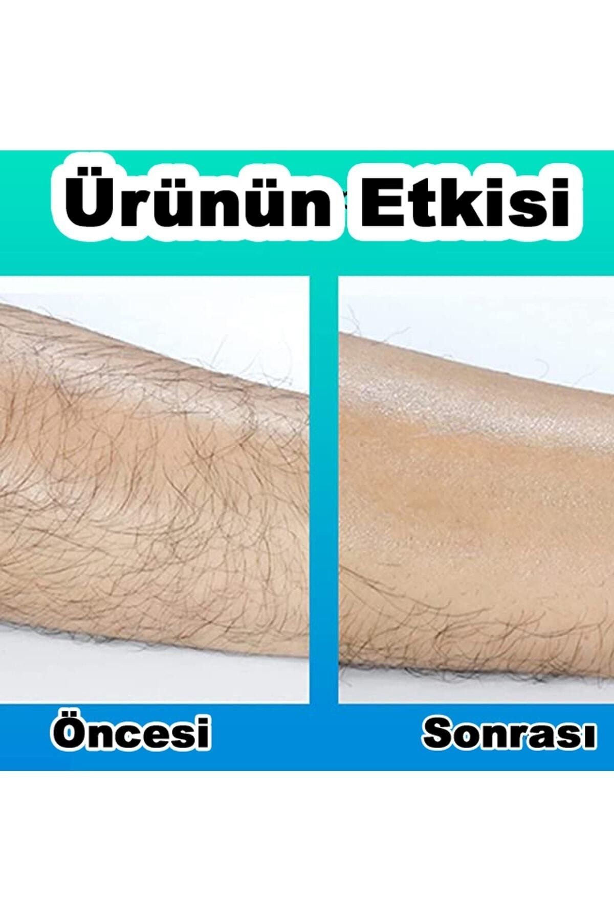 ONULISS Kristal Epilatör Crystal Eraser Sertifikalı OH8133