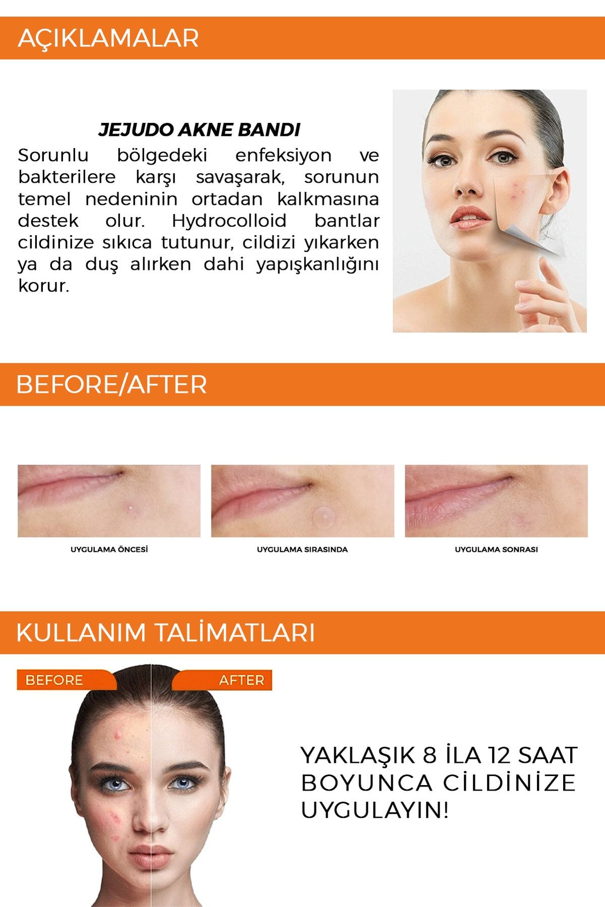 JEJUDO-Ceuticals Original Pimple Patch 36 Patch Acne and Acne Patch 4