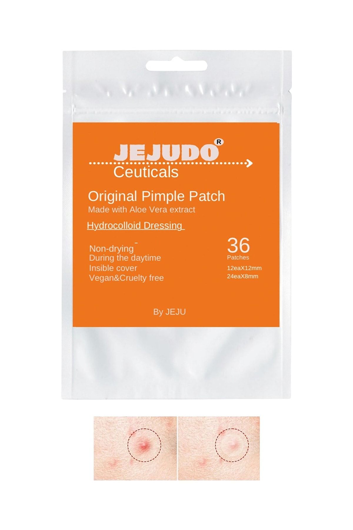 JEJUDO-Ceuticals Original Pimple Patch 36 Patch Acne and Acne Patch 2