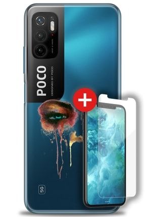 Xiaomi Poco M3 Pro Kılıf Hd Baskılı Kılıf - Kanlı Gözler + Temperli Cam zmxi-poco-m3-pro-v-241-cm
