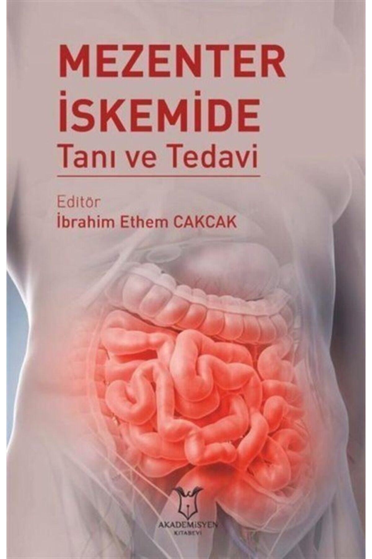 Mezenter İskemide Tanı ve Tedavi