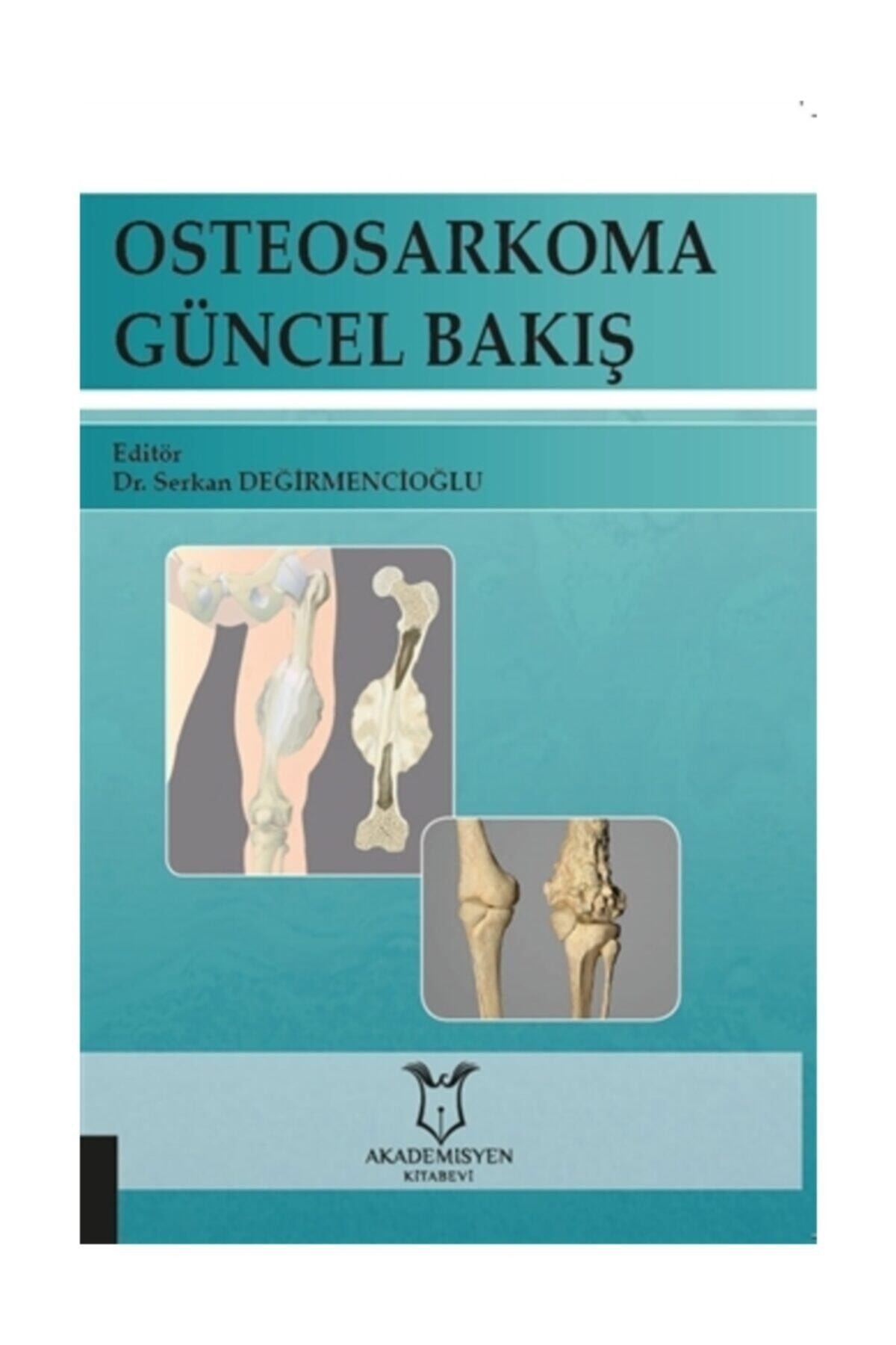 Osteosarkoma Güncel Bakış