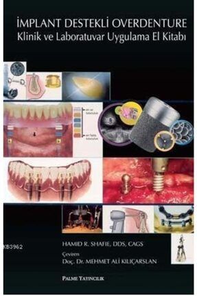 Implant Destekli Overdenture Klinik Ve - Palme Yay PALME-95050