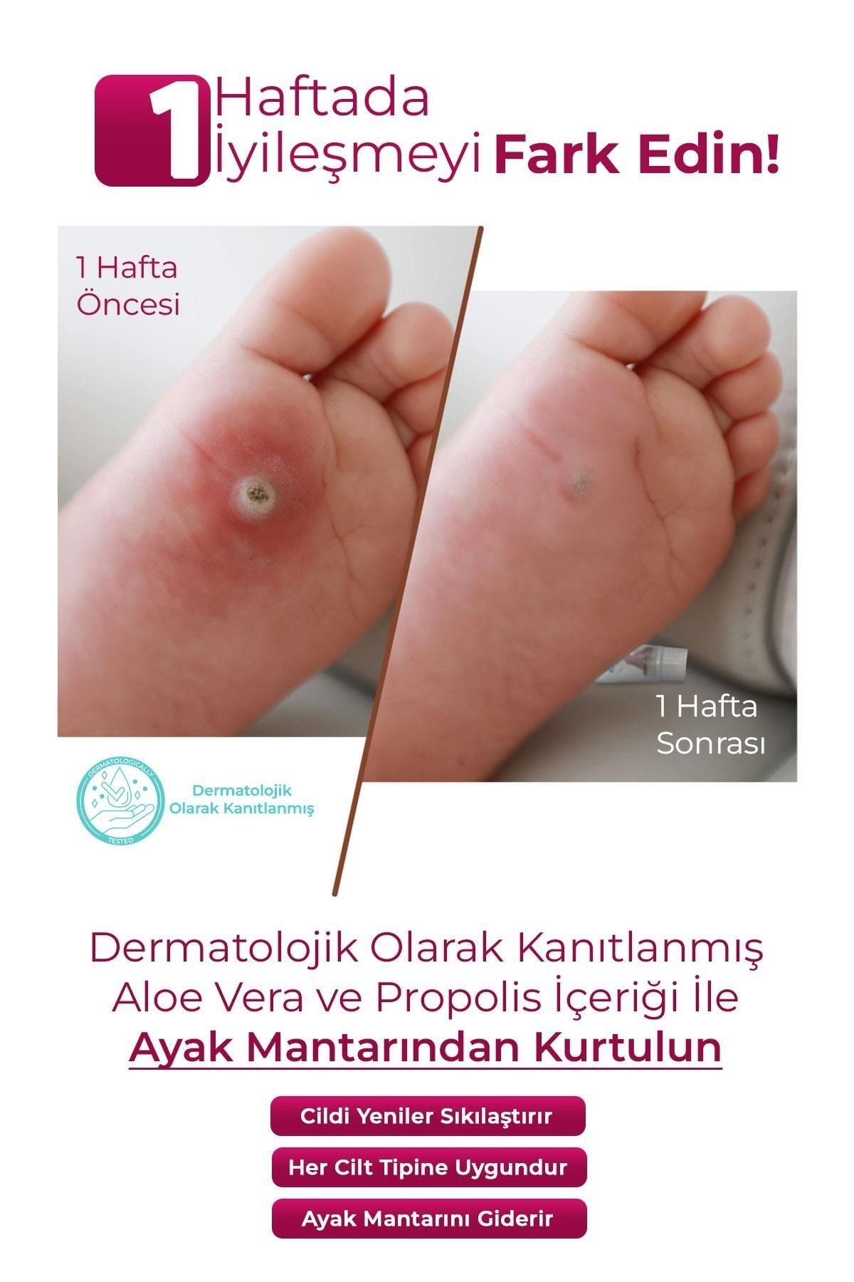 Valerian Ayak Kokusu Ve El, Tırnak, Mantar Jeli 25 Ml QN7915