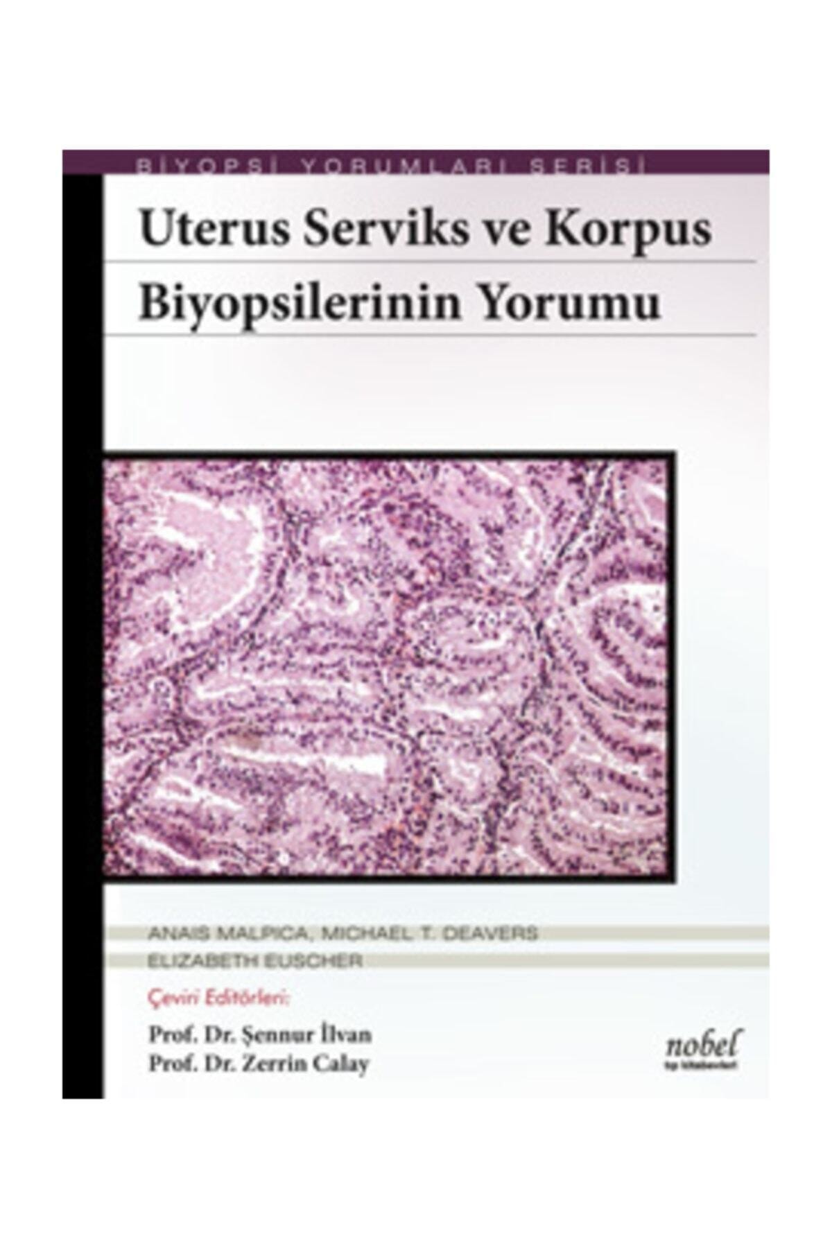 Nobel Tıp Kitabevi Biyopsilerin Yorumu: Uterus Serviks Ve Korpus