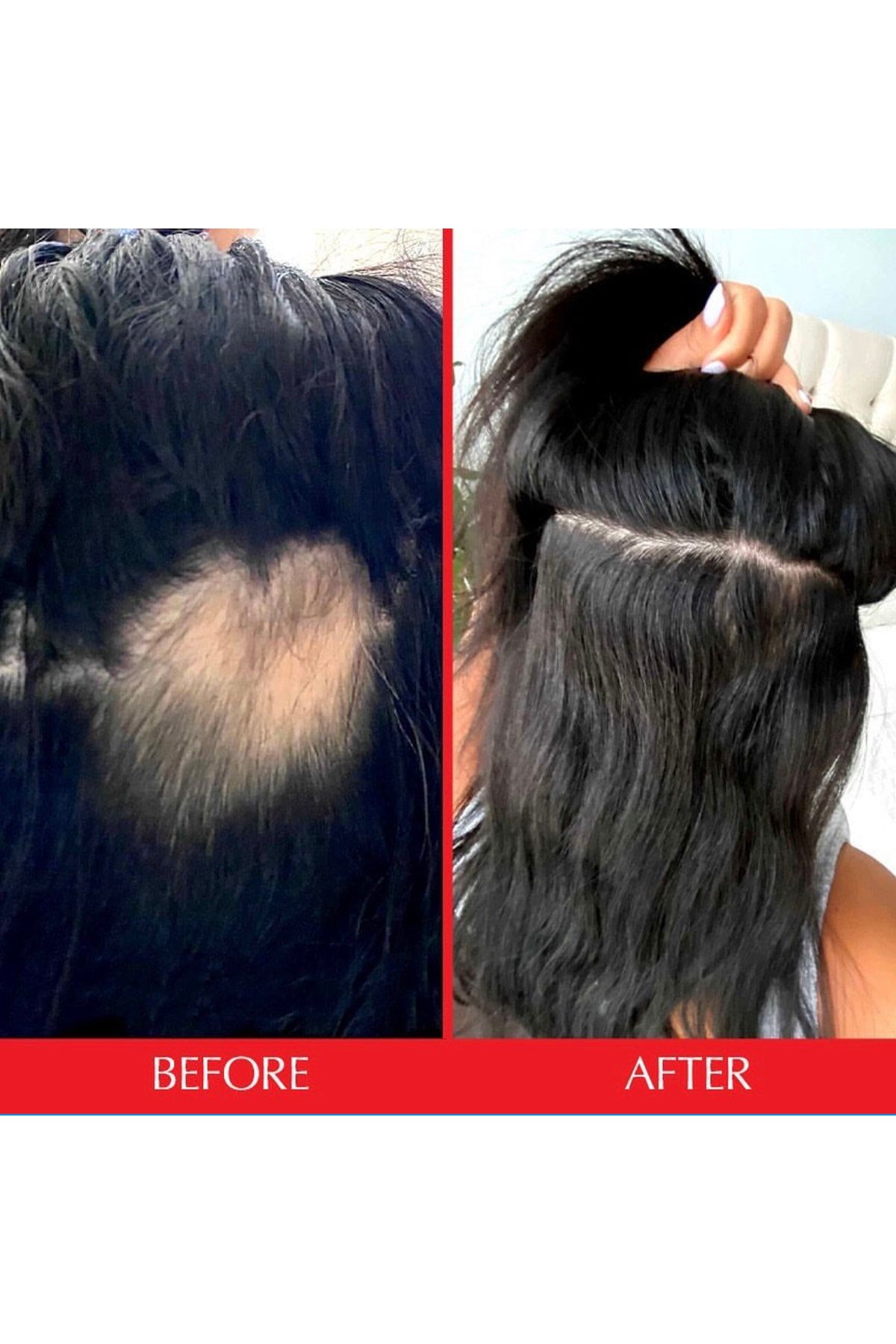 HAIRtamin سرم ضد ریزش مو تقویت کننده و افزایش ضخامت مو جلوگیری از ریزش مو 120میل