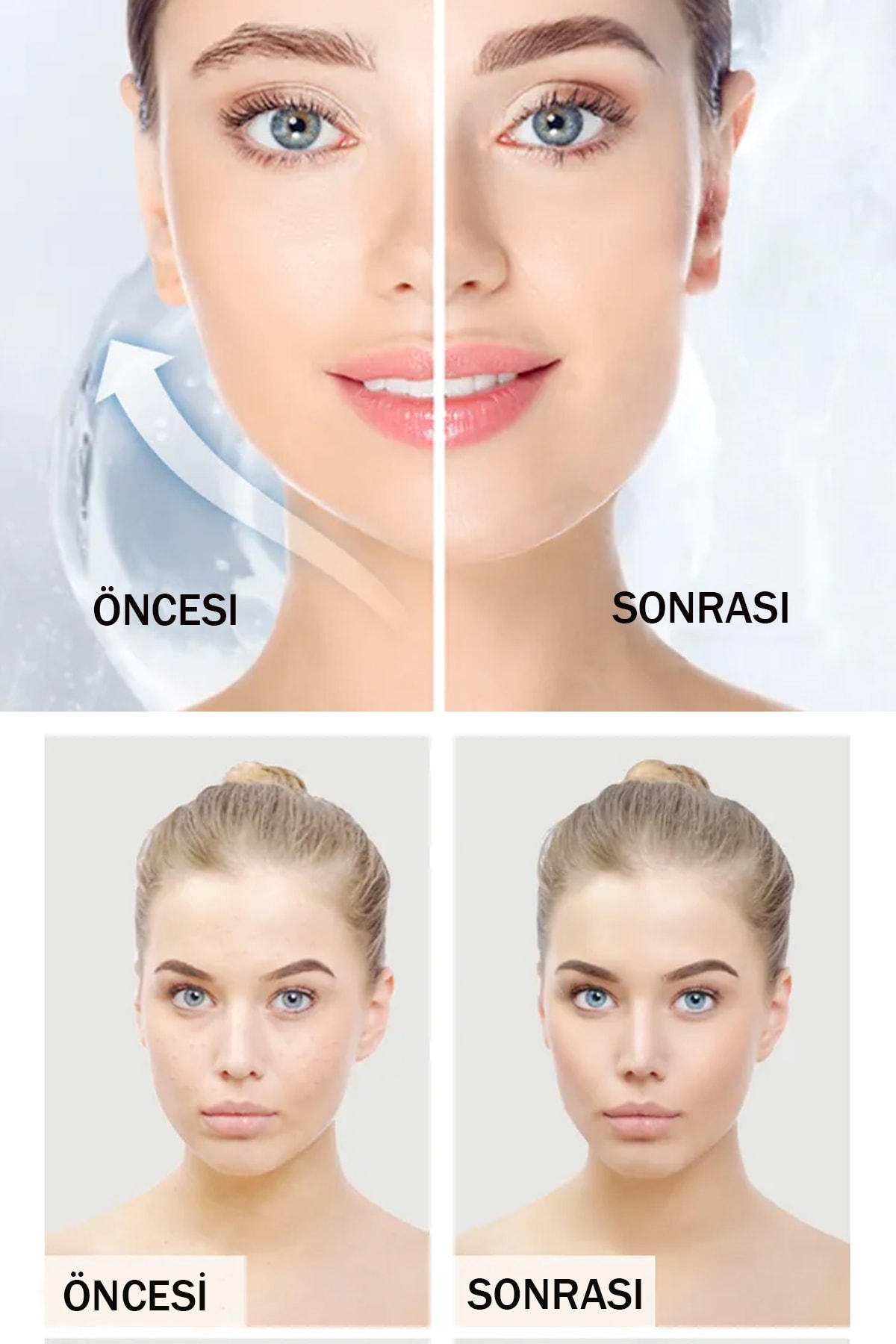 ماسک صورت   Xolo | XGBK23 اورجینال - تصویر 7