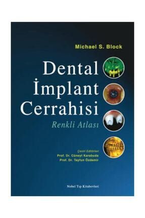Dental Implant Cerrahisi Renkli Atlası TR2068