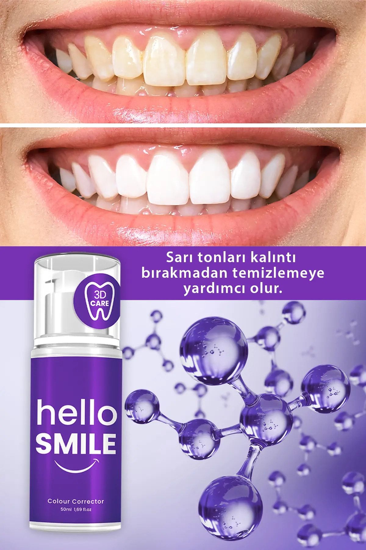 PROCSIN ژل سفید کننده فوری Hello Smile از بین بردن تمام زردی دندان 50میل