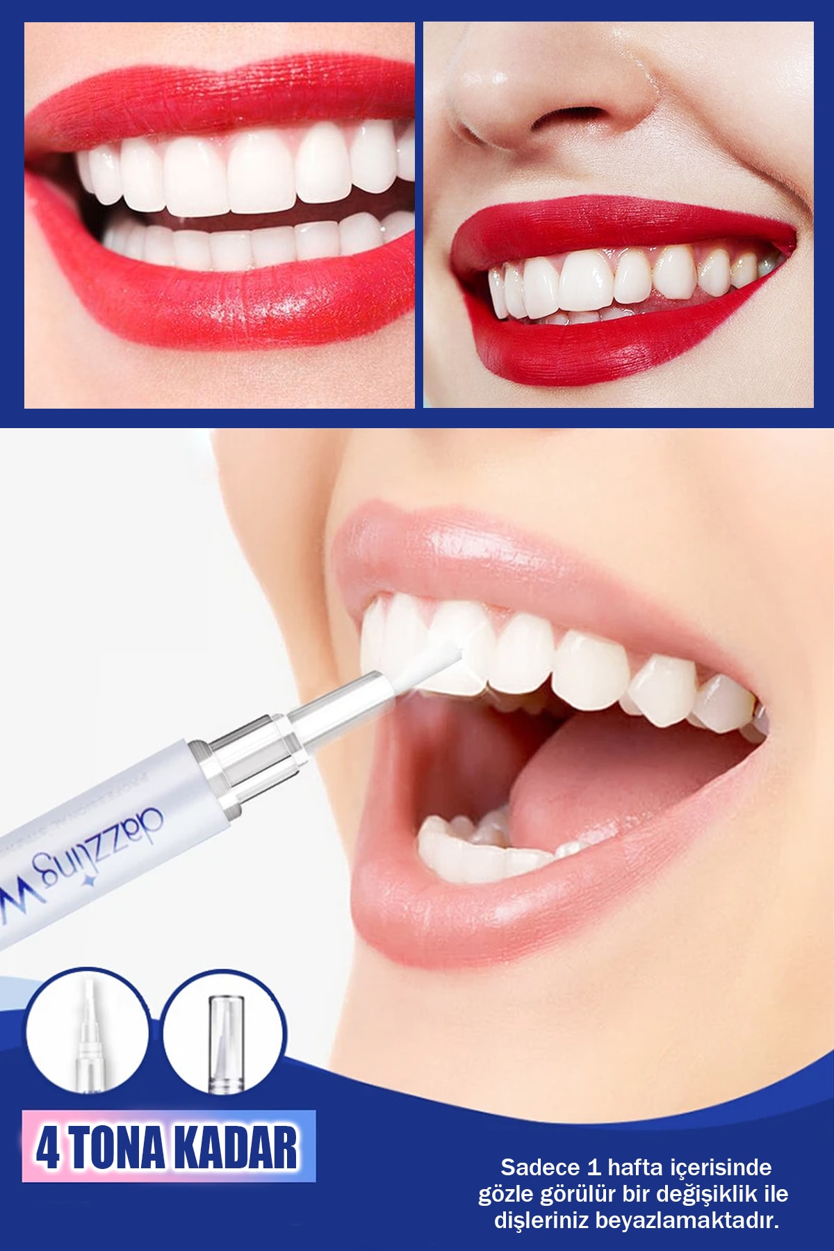 xolo 6 Adet Dazzling White Diş Temizleme Kalemi Diş Silgisi Acil Diş Kalemi