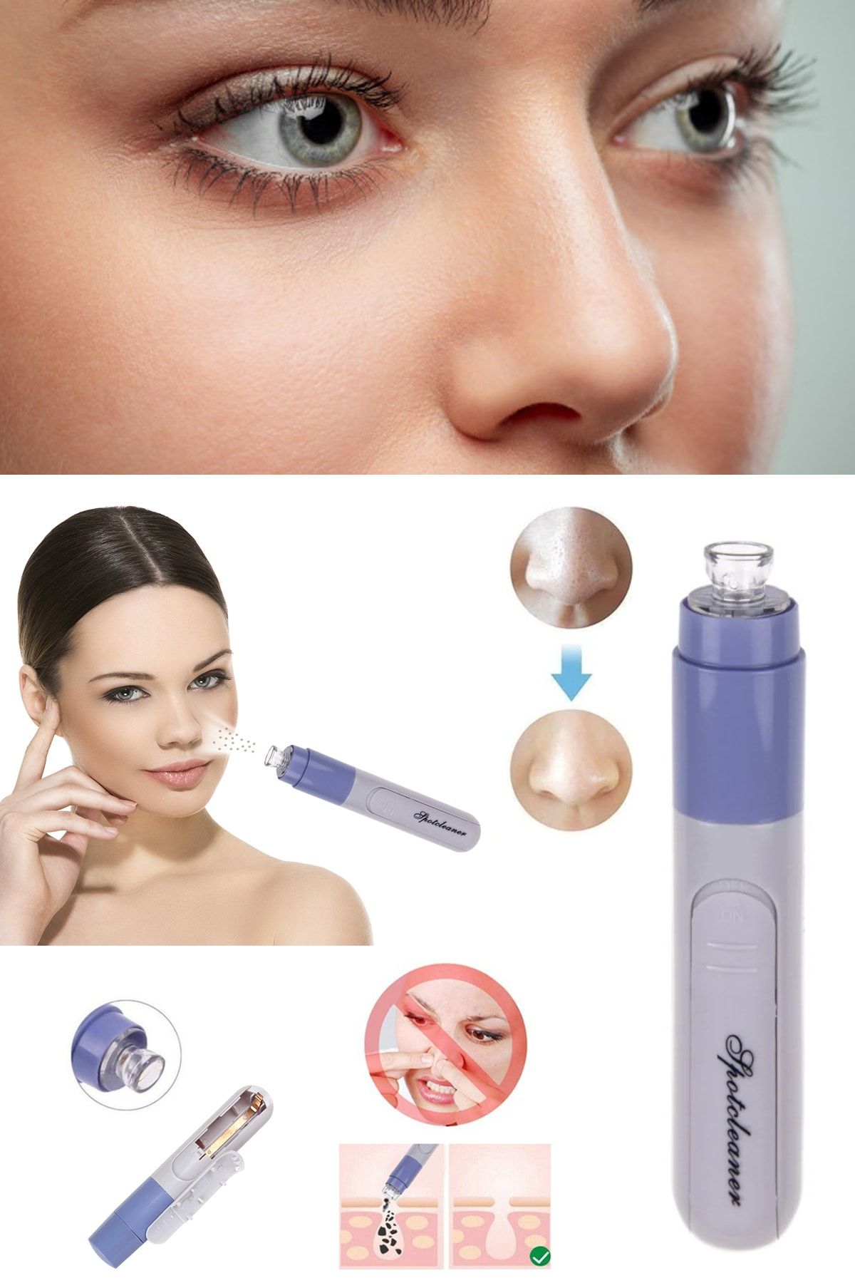 Xolo Pore Cleaner Vakumlu Siyah Nokta Temizleyici Yuz Temizleme 8297415579325 Trendyol