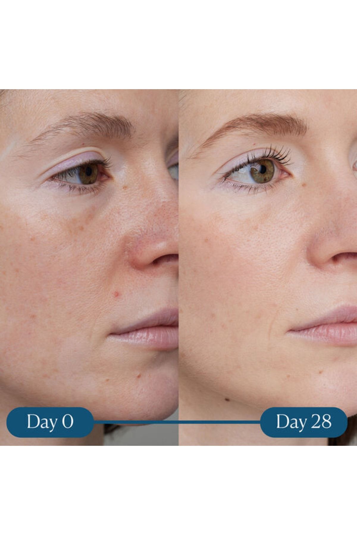 Elemis-Dynamic Resurfacing Serum with Vitamin C - Pore Firming, 30ml 641628401550 5