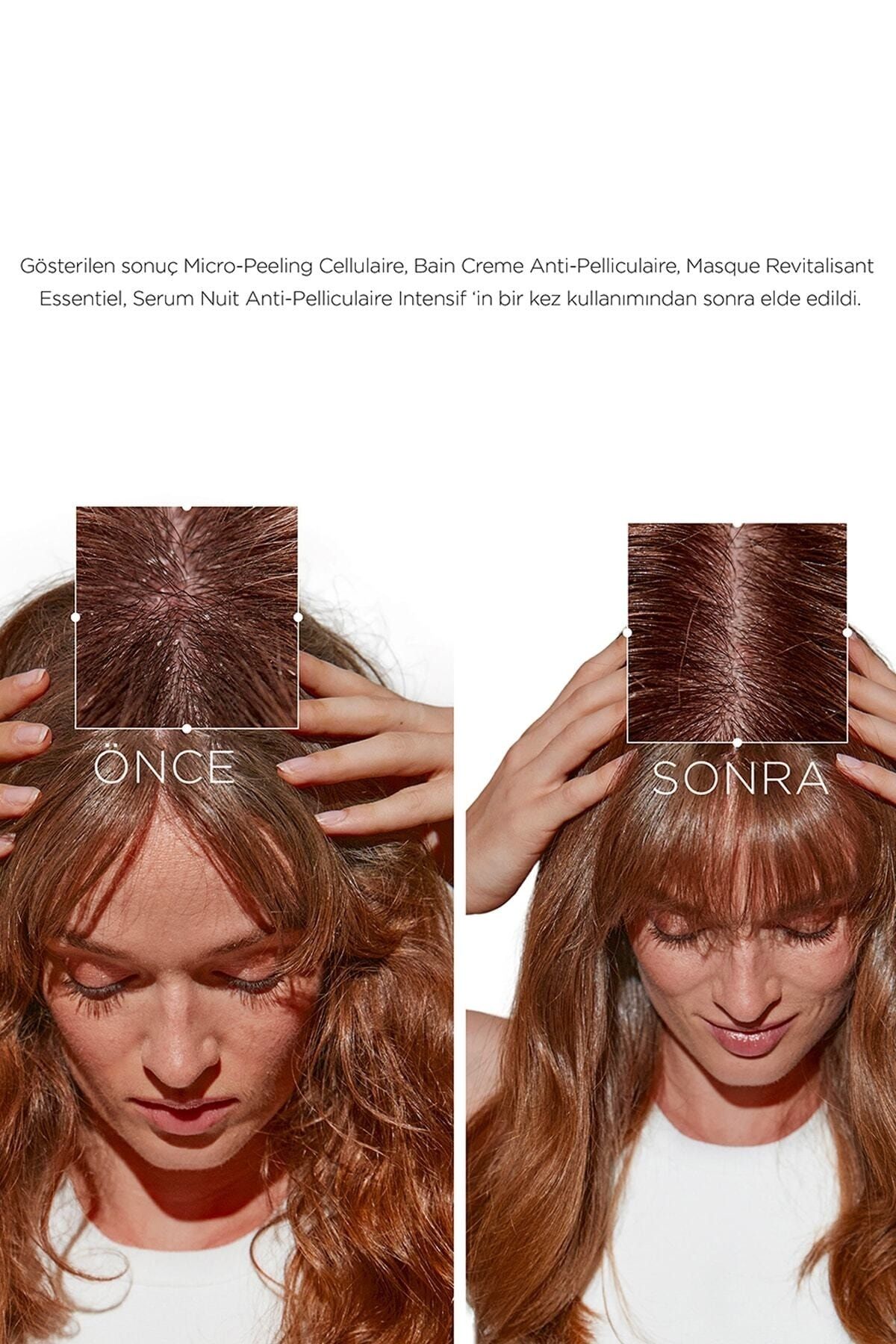 Kerastase-Shine35 Potion Symbiose - 250 Ml Anti-Dandruff Purifying Cellular Shampoo 4