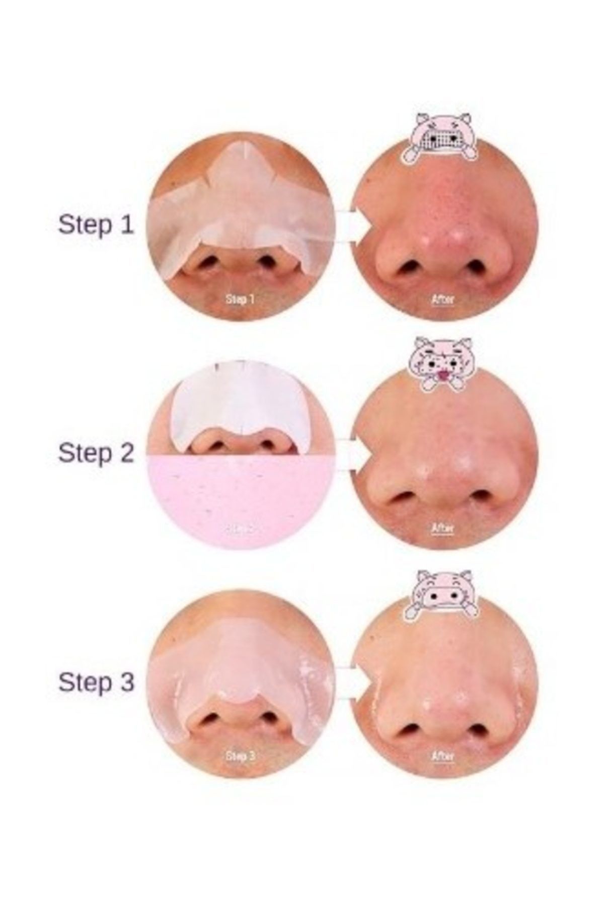 پاک کننده صورت کیت 3 مرحله ای سر سیاه و سفید خوک Holika Holika