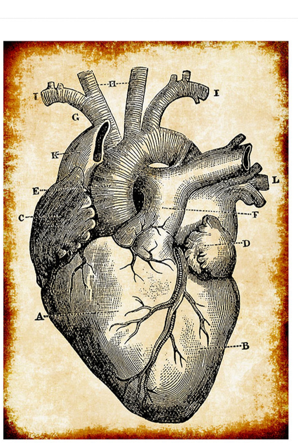 ct sağlık için kalp anatomisi posteri ABDde yüksek tansiyon nasıl tedavi edilir?