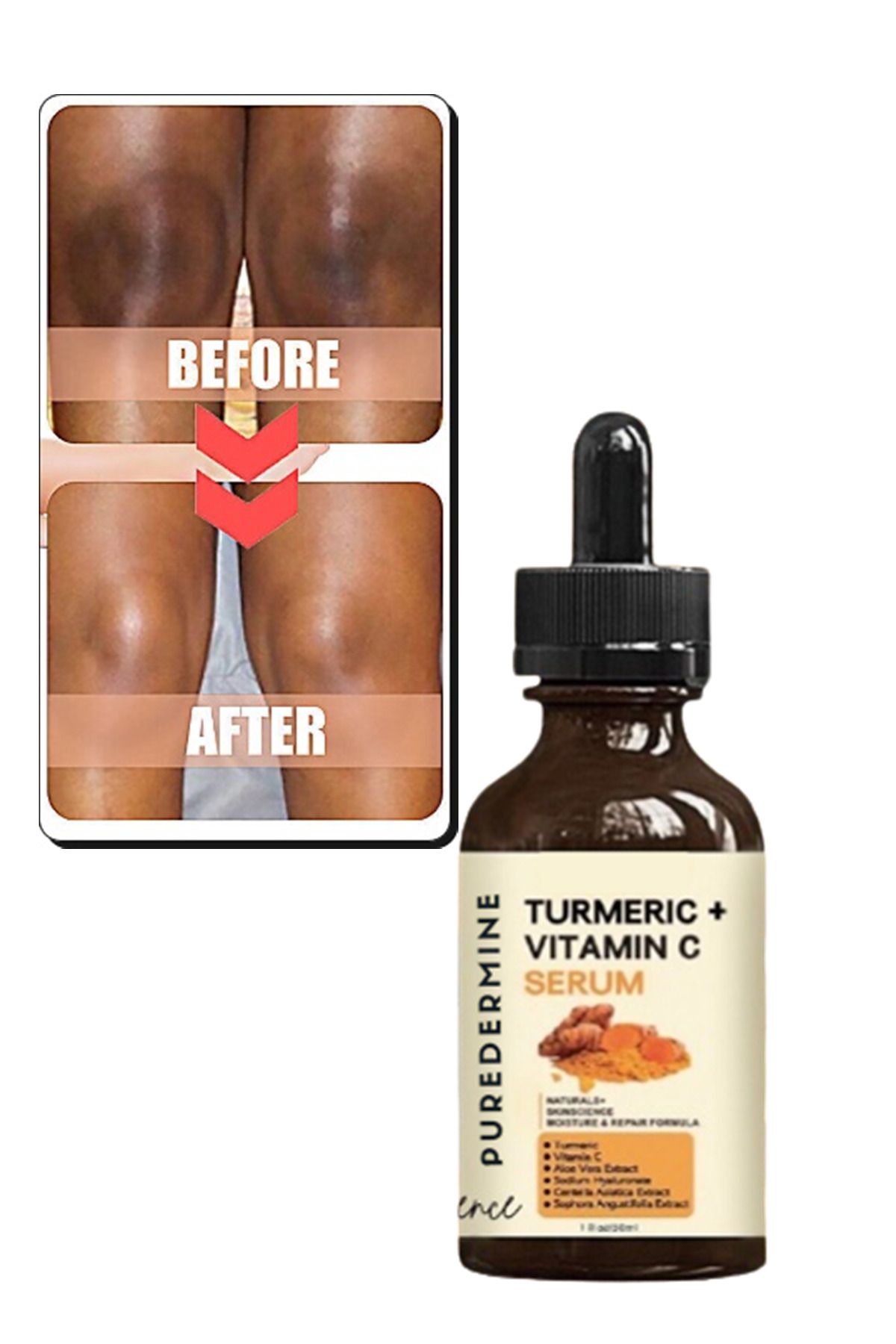 Puredermine-Strong Whitening Turmeric Serum Dark Spot & Acne & Melasma & Dark Joint & Finger Knee and Elbow 2