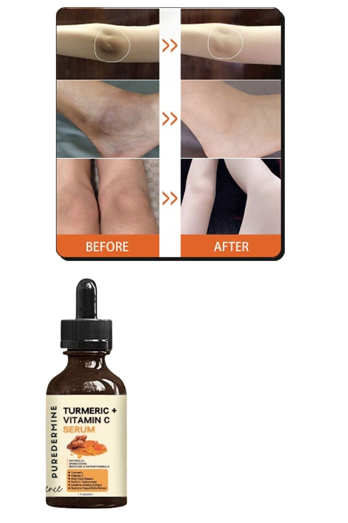 Puredermine-Strong Whitening Turmeric Serum Dark Spot & Acne & Melasma & Dark Joint & Finger Knee and Elbow 4