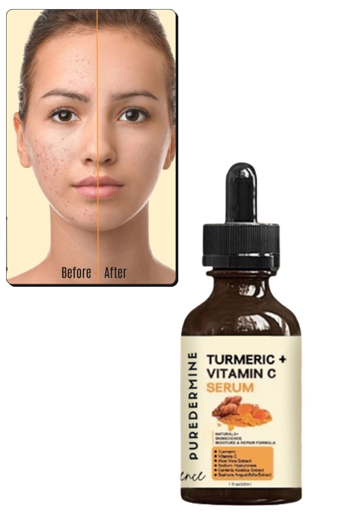 Puredermine-Strong Whitening Turmeric Serum Dark Spot & Acne & Melasma & Dark Joint & Finger Knee and Elbow 3